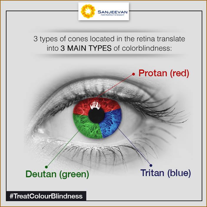 Colour Blindness Treatment in India | Sanjeevan